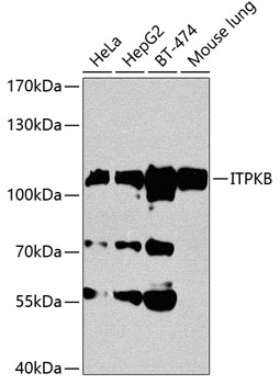 Western blot - ITPKB Polyclonal Antibody 