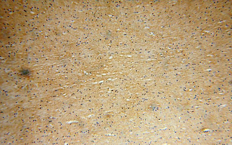 Immunohistochemical of paraffin-embedded human brain using Catalog No:110492(EVI2A antibody) at dilution of 1:100 (under 10x lens)