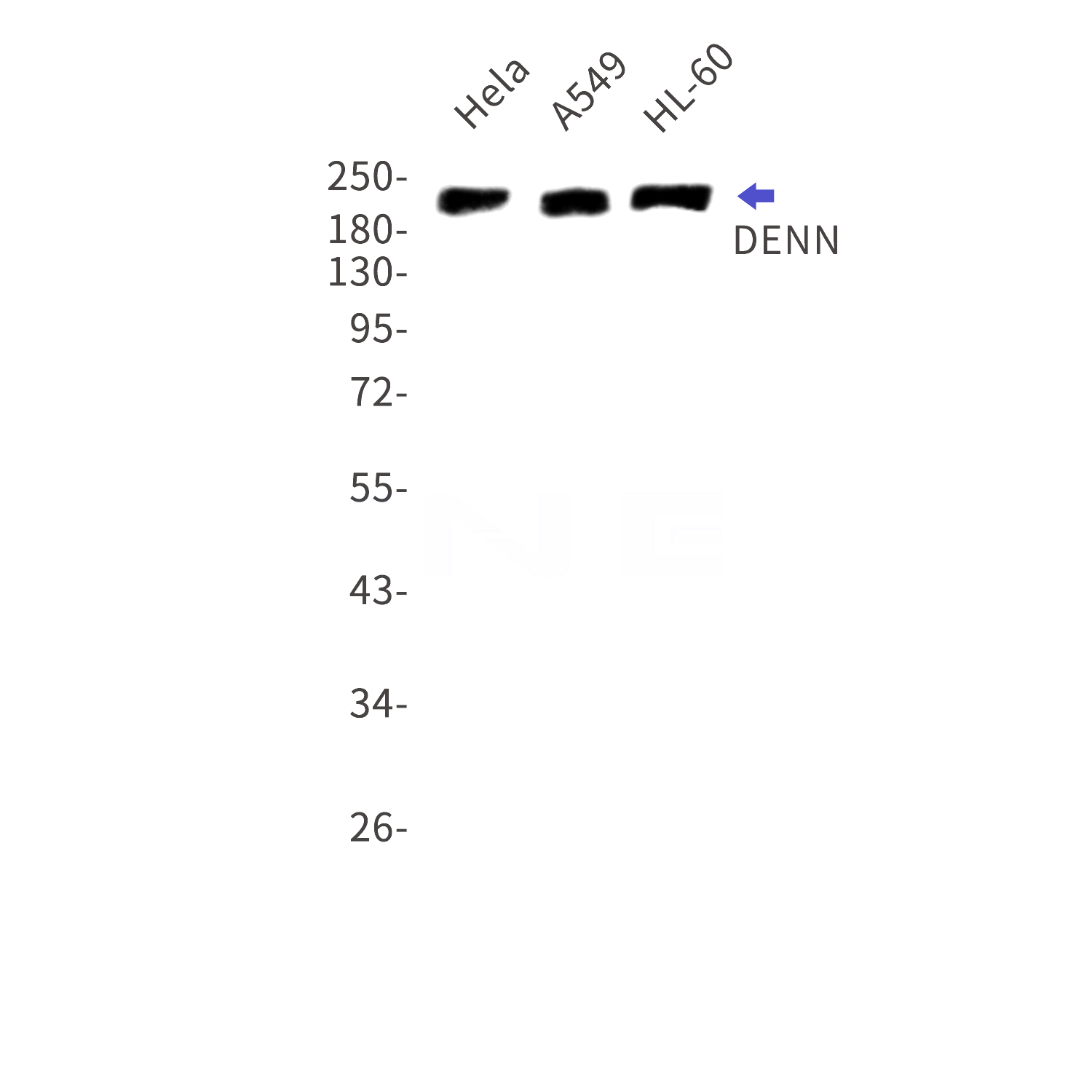 Western blot detection of DENN in Hela,A549,HL-60 cell lysates using DENN Rabbit mAb(1:1000 diluted).Predicted band size:183kDa.Observed band size:220kDa.
