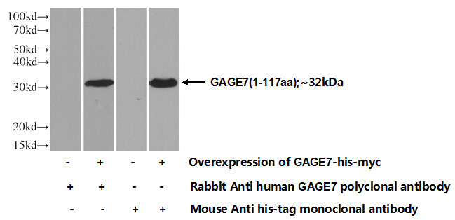 Transfected HEK-293 cells were subjected to SDS PAGE followed by western blot with Catalog No:110826(GAGE7 Antibody) at dilution of 1:700