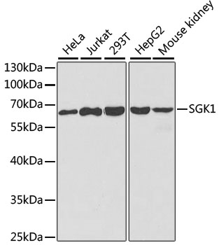 Western blot - SGK1 Polyclonal Antibody 