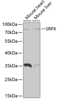 Western blot - SRPX Polyclonal Antibody 