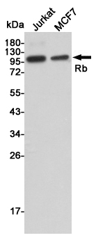 Western blot detection of Rb in Jurkat and MCF7 cell lysates using Rb mouse mAb (1:2000 diluted).Predicted band size:106KDa.Observed band size:110KDa.