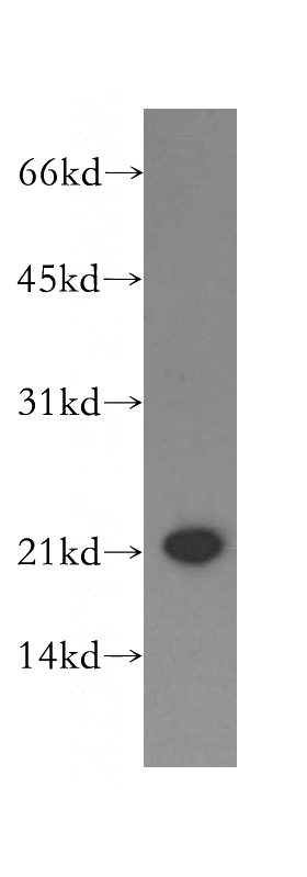 HEK-293 cells were subjected to SDS PAGE followed by western blot with Catalog No:113794(PGRMC1 antibody) at dilution of 1:400