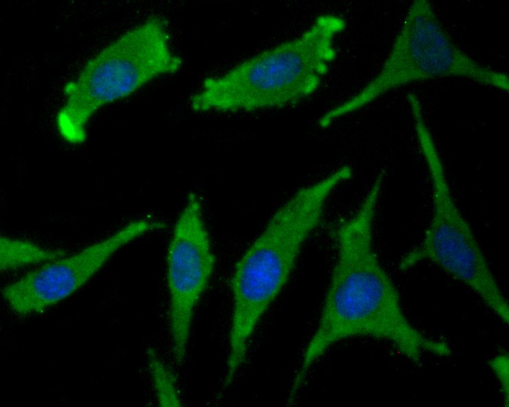 Fig3: ICC staining WSCD2 in SH-SY5Y cells (green). The nuclear counter stain is DAPI (blue). Cells were fixed in paraformaldehyde, permeabilised with 0.25% Triton X100/PBS.