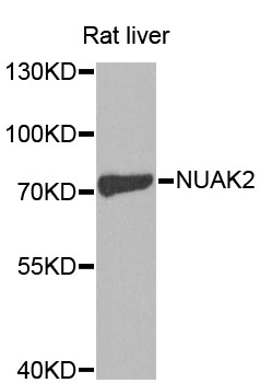 Western blot - NUAK2 Polyclonal Antibody 