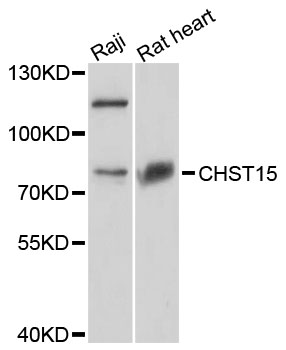 Western blot - CHST15 Polyclonal Antibody 