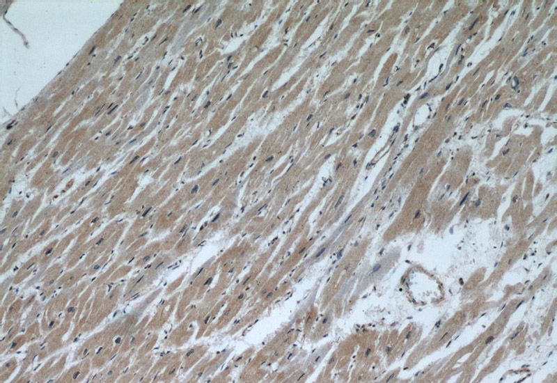 Immunohistochemical of paraffin-embedded human heart using Catalog No:108829(CALML6 antibody) at dilution of 1:50 (under 10x lens)
