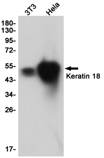 Western blot detection of Keratin 18 in 3T3,Hela cell lysates using Keratin 18 (4G8) Mouse mAb(1:1000 diluted).Predicted band size:46KDa.Observed band size:46KDa.