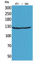 Fig1:; Western Blot analysis of 4T1, 293 cells using Integrin αD Polyclonal Antibody.. Secondary antibody（catalog#：HA1001) was diluted at 1:20000