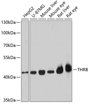 Western blot - THRB Polyclonal Antibody 