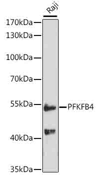 Western blot - PFKFB4 Polyclonal Antibody 