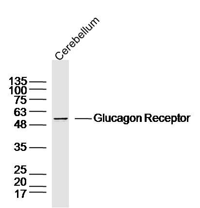 Fig4: Sample: Cerebellum (Mouse) Lysate at 40 ug; Primary: Anti-Glucagon Receptor at 1/300 dilution; Secondary: IRDye800CW Goat Anti-Rabbit IgG at 1/20000 dilution; Predicted band size: 51 kD; Observed band size: 51 kD