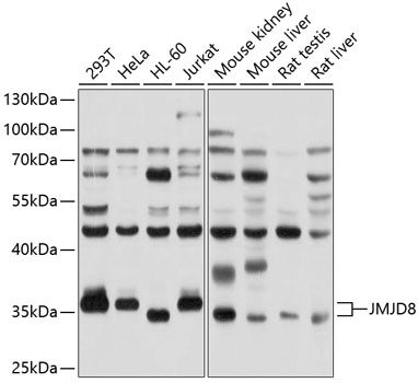 Western blot - JMJD8 Polyclonal Antibody 