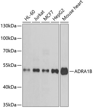 Western blot - ADRA1B Polyclonal Antibody 