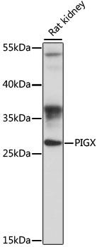 Western blot - PIGX Polyclonal Antibody 