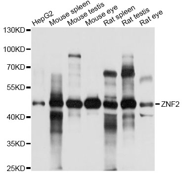 Western blot - ZNF2 Polyclonal Antibody 