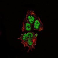 Immunofluorescence analysis of NTERA-2 cells using SOX2 mouse mAb (green). Red