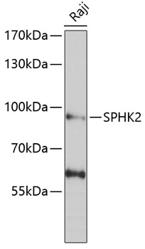 Western blot - SPHK2 Polyclonal Antibody 