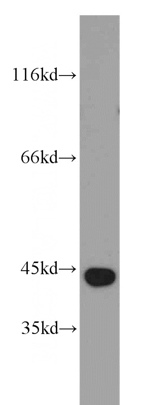 human brain tissue were subjected to SDS PAGE followed by western blot with Catalog No:108296(ATG4B antibody) at dilution of 1:800