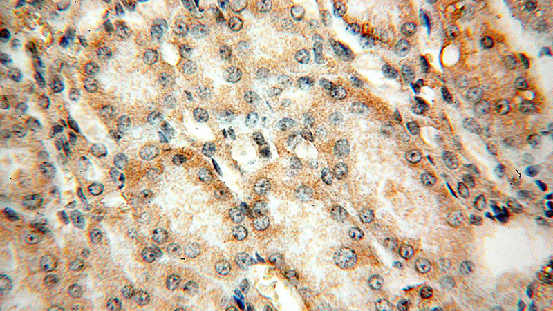Immunohistochemical of paraffin-embedded human kidney using Catalog No:112844(MRPS17 antibody) at dilution of 1:50 (under 40x lens)