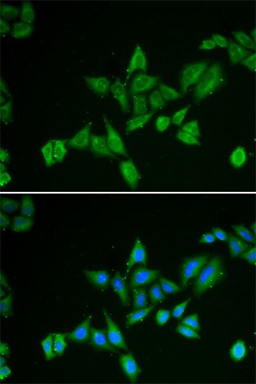 Immunofluorescence - BNIP2 Polyclonal Antibody 