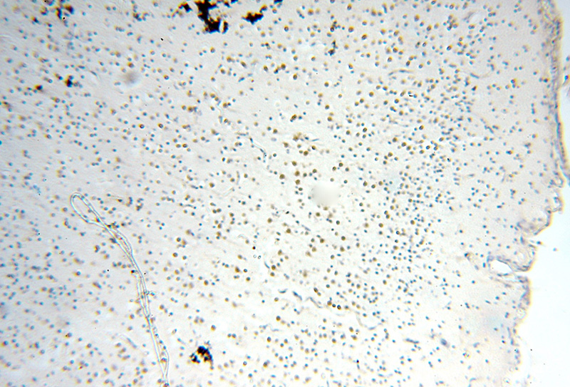 Immunohistochemical of paraffin-embedded human brain using Catalog No:112636(MEF2C antibody) at dilution of 1:50 (under 10x lens)