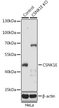 Western blot - CSNK1E Polyclonal Antibody 