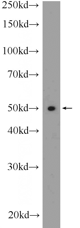 K-562 cells were subjected to SDS PAGE followed by western blot with Catalog No:116454(TXNIP Antibody) at dilution of 1:600