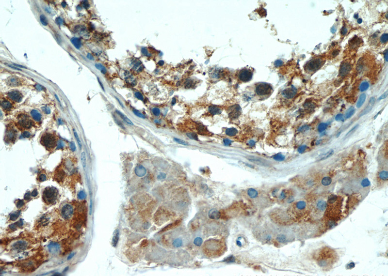 Immunohistochemistry of paraffin-embedded human testis tissue slide using Catalog No:112094(KLHL15 Antibody) at dilution of 1:50 (under 40x lens)