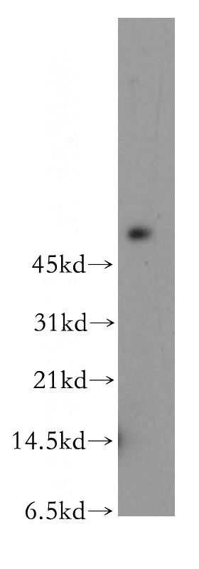 HeLa cells were subjected to SDS PAGE followed by western blot with Catalog No:109381(COL4A6 antibody) at dilution of 1:1000