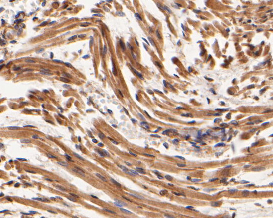 Fig6:; Immunohistochemical analysis of paraffin-embedded human skeletal muscletissue using anti-SYNDIG1 antibody. The section was pre-treated using heat mediated antigen retrieval with Tris-EDTA buffer (pH 8.0-8.4) for 20 minutes.The tissues were blocked in 5% BSA for 30 minutes at room temperature, washed with ddH; 2; O and PBS, and then probed with the primary antibody ( 1/400) for 30 minutes at room temperature. The detection was performed using an HRP conjugated compact polymer system. DAB was used as the chromogen. Tissues were counterstained with hematoxylin and mounted with DPX.