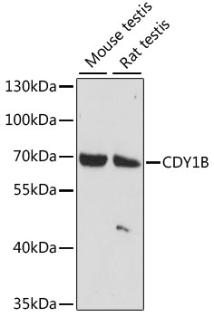 Western blot - CDY1B Polyclonal Antibody 
