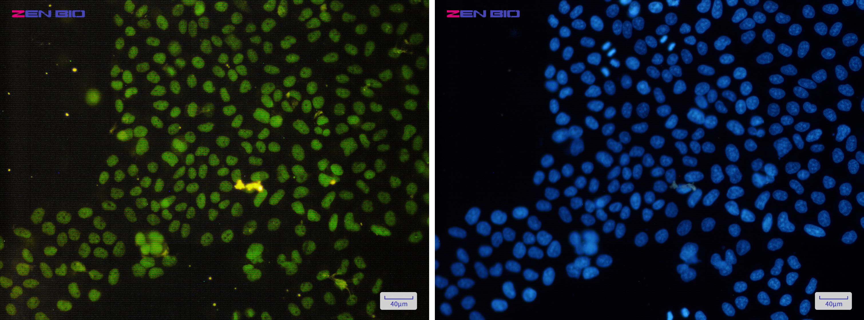 Immunocytochemistry of ASH2L(green) in Hela cells using ASH2L Rabbit pAb at dilution 1/50, and DAPI(blue)