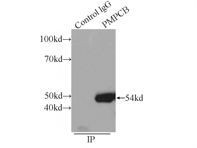 IP Result of anti-PMPCB (IP:Catalog No:114028, 3ug; Detection:Catalog No:114028 1:500) with MCF-7 cells lysate 2560ug.