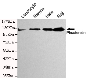 Western blot detection of Phostensin in Hela,Raji,Ramos and Leucocyte cell lysates and using Phostensin mouse mAb (1:200 diluted).Predicted band size: 120KDa.Observed band size: 120KDa.