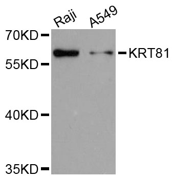 Western blot - KRT81 Polyclonal Antibody 