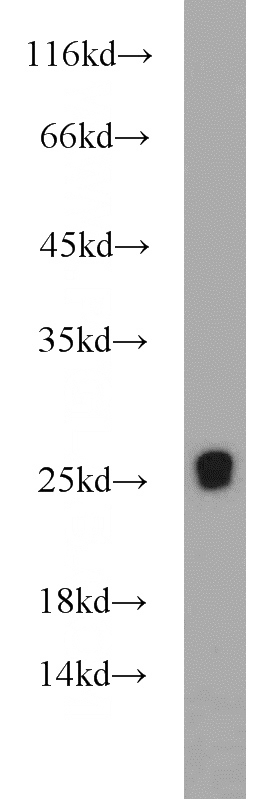human heart tissue were subjected to SDS PAGE followed by western blot with Catalog No:114639(RGR antibody) at dilution of 1:500