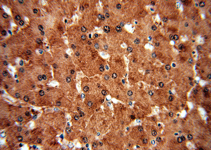Immunohistochemical of paraffin-embedded human liver using Catalog No:115171(SGMS1 antibody) at dilution of 1:50 (under 40x lens)