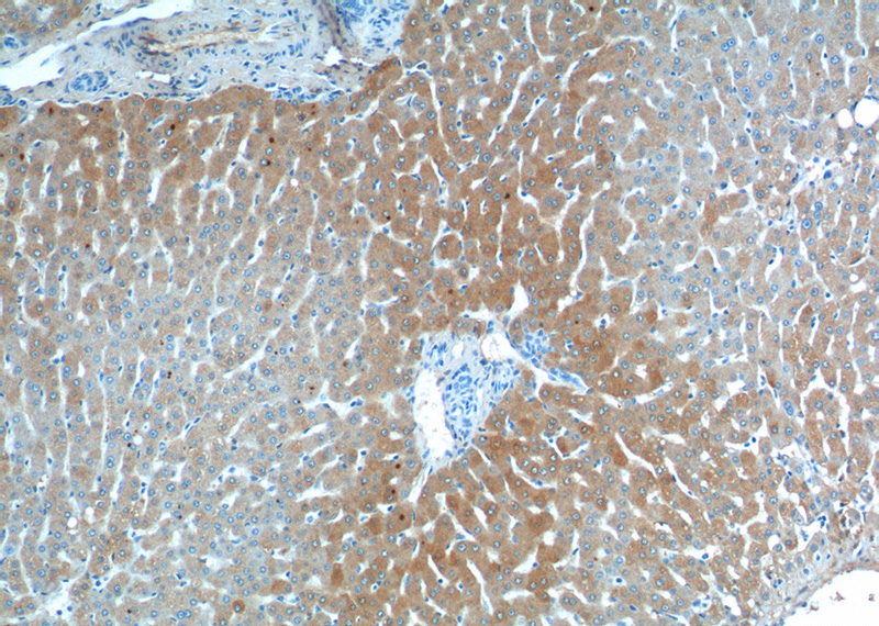Immunohistochemistry of paraffin-embedded human liver tissue slide using Catalog No:108718(C3 Antibody) at dilution of 1:100 (under 10x lens).