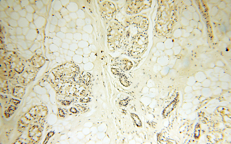 Immunohistochemical of paraffin-embedded human skin using Catalog No:111653(IL1B antibody) at dilution of 1:50 (under 10x lens)