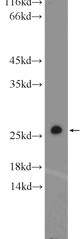 mouse brain tissue were subjected to SDS PAGE followed by western blot with Catalog No:114416(RAB1A Antibody) at dilution of 1:1000