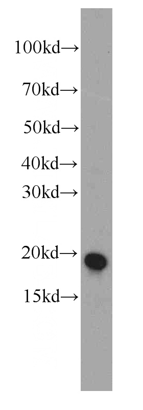 Jurkat cells were subjected to SDS PAGE followed by western blot with Catalog No:107607(STMN1 antibody) at dilution of 1:1000