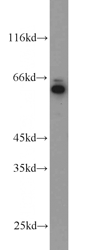 HepG2 cells were subjected to SDS PAGE followed by western blot with Catalog No:110060(DBH antibody) at dilution of 1:1000