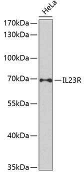 Western blot - IL23R Polyclonal Antibody 