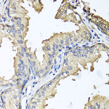 Immunohistochemistry - CXCR4 Polyclonal Antibody 