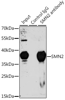 Immunoprecipitation - SMN2 Polyclonal Antibody 