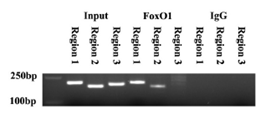 ChIP-PCR detected the FoxO1 binding sites in the AdipoQ promoter region.