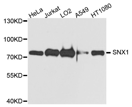 Western blot - SNX1 Polyclonal Antibody 