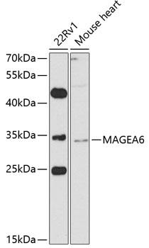 Western blot - MAGEA6 Polyclonal Antibody 